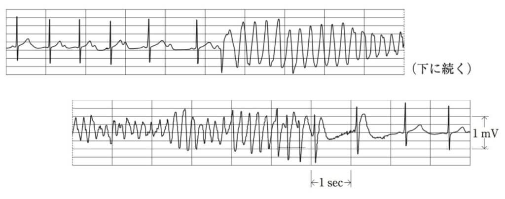 トルサード・ド・ポワントの危険にさらされているのは誰ですか?